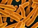 Resistent gegen Antibiotika: E-Coli-Bakterien.
